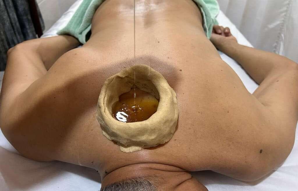 Greeva/Kati/Janu Basti (Neck, Back, Knee)
